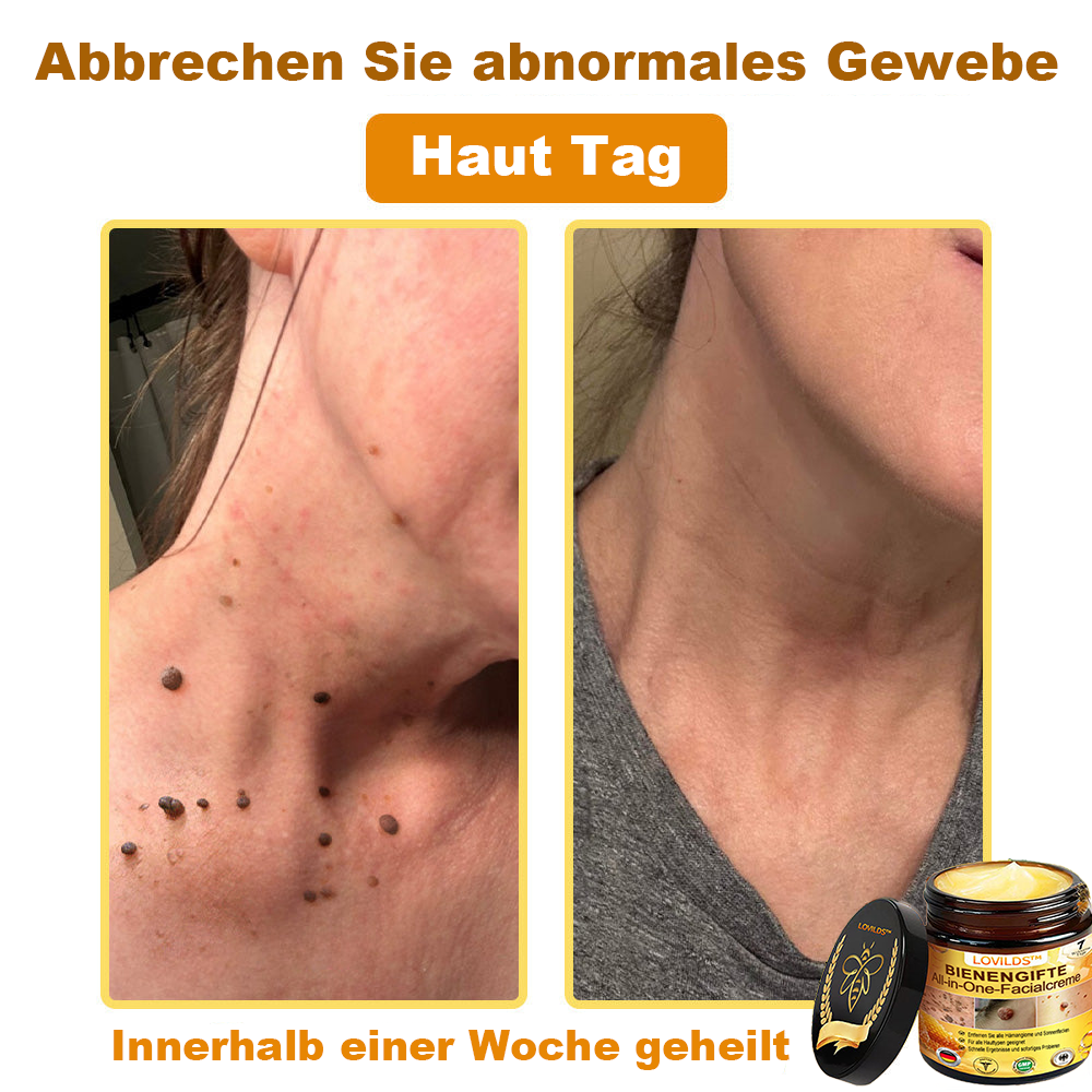 [offizieller Markenshop] 🐝 LOVILDS™ Bienengift-All-Action-Creme (👩‍⚕️ Deutsche Dermatologische Gesellschaft e.V. 𝟐𝟎𝟐𝟓Besonders empfehlenswerte Produkte)