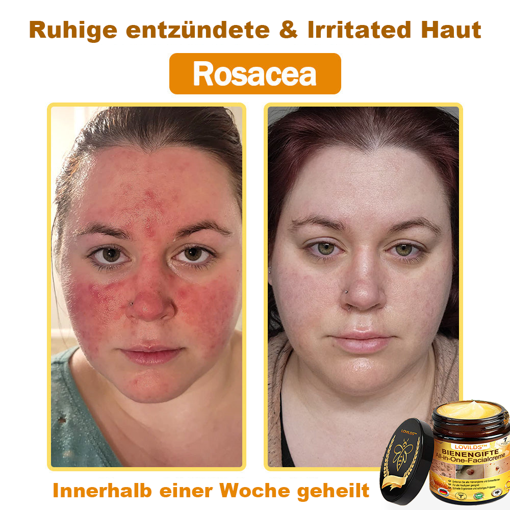 [offizieller Markenshop] 🐝 LOVILDS™ Bienengift-All-Action-Creme (👩‍⚕️ Deutsche Dermatologische Gesellschaft e.V. 𝟐𝟎𝟐𝟓Besonders empfehlenswerte Produkte)
