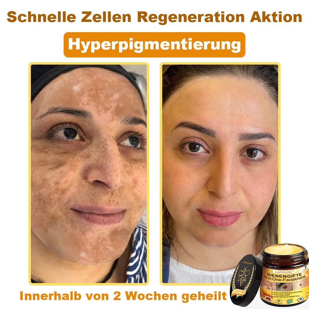[offizieller Markenshop] 🐝 LOVILDS™ Bienengift-All-Action-Creme (👩‍⚕️ Deutsche Dermatologische Gesellschaft e.V. 𝟐𝟎𝟐𝟓Besonders empfehlenswerte Produkte)