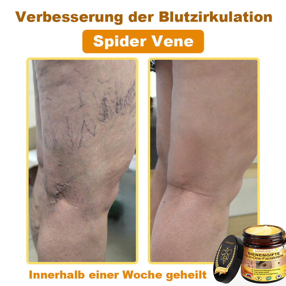[offizieller Markenshop] 🐝 LOVILDS™ Bienengift-All-Action-Creme (👩‍⚕️ Deutsche Dermatologische Gesellschaft e.V. 𝟐𝟎𝟐𝟓Besonders empfehlenswerte Produkte)