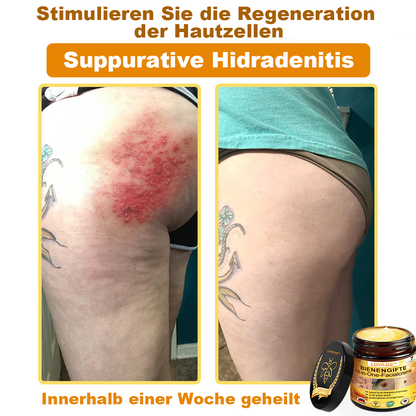 [offizieller Markenshop] 🐝 LOVILDS™ Bienengift-All-Action-Creme (👩‍⚕️ Deutsche Dermatologische Gesellschaft e.V. 𝟐𝟎𝟐𝟓Besonders empfehlenswerte Produkte)